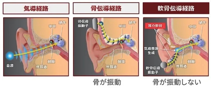 軟骨伝導と他の伝導の違い