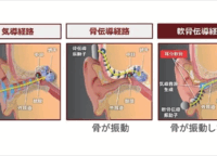 骨伝導の次は「軟骨伝導」！耳を塞がない新感覚イヤホン「サウンドボール(R)」が登場
